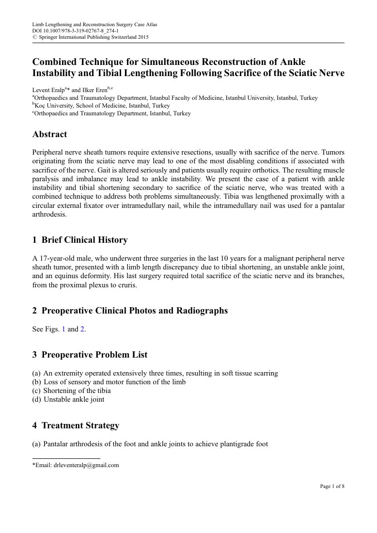 Simultaneous Ankle Reconstruction and Tibial Lengthening — ilk sayfa