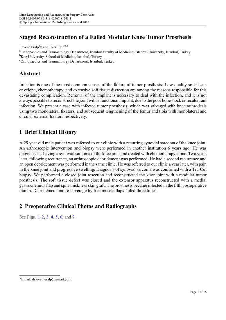 Staged Reconstruction of a Failed Modular Knee Tumor Prosthesis — ilk sayfa