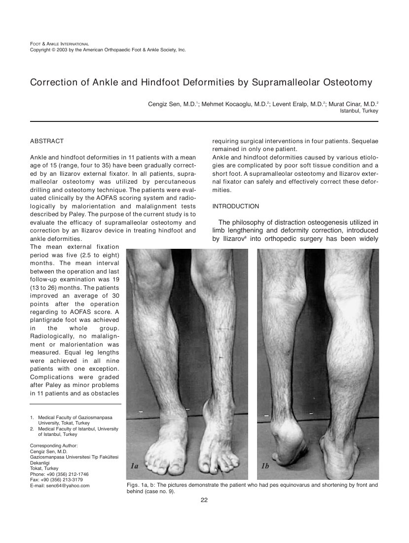 Correction of ankle and hindfoot deformities by supramalleolar osteotomy — ilk sayfa