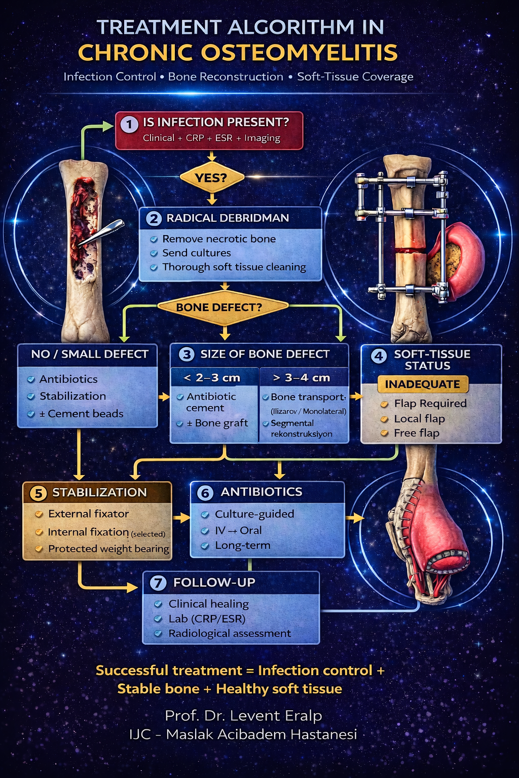 Treatment Algorithm in Chronic Osteomyelitis