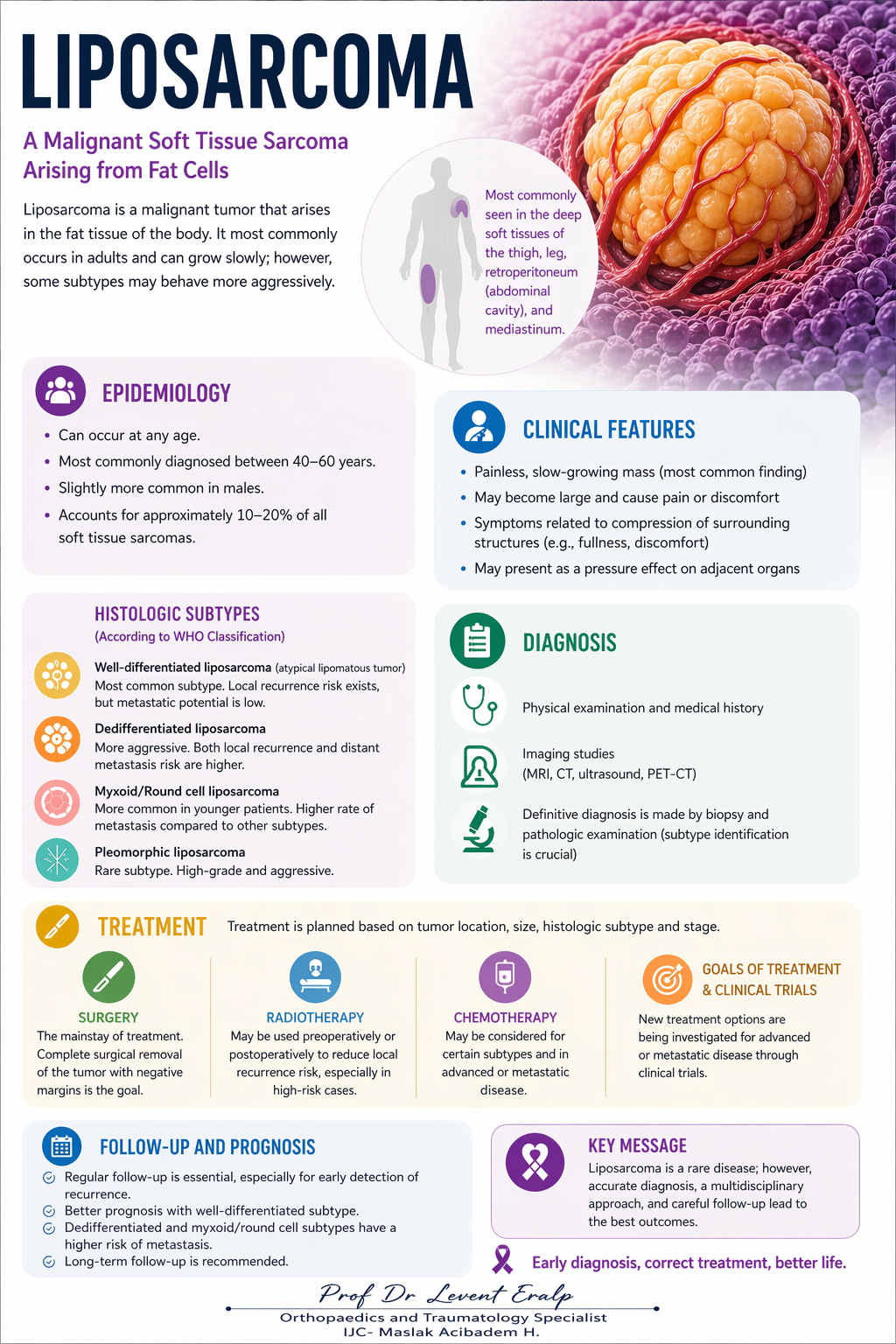 Liposarcoma
