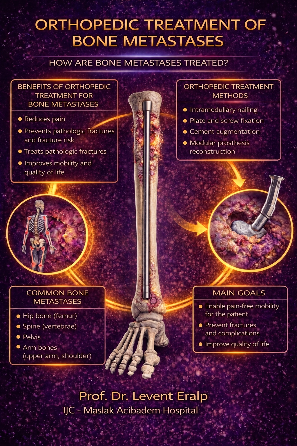 Orthopedic Treatment of Bone Metastases