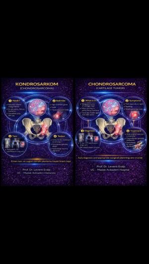 Kondrosarkom / Chondrosarcoma (Cartilage Tumor)